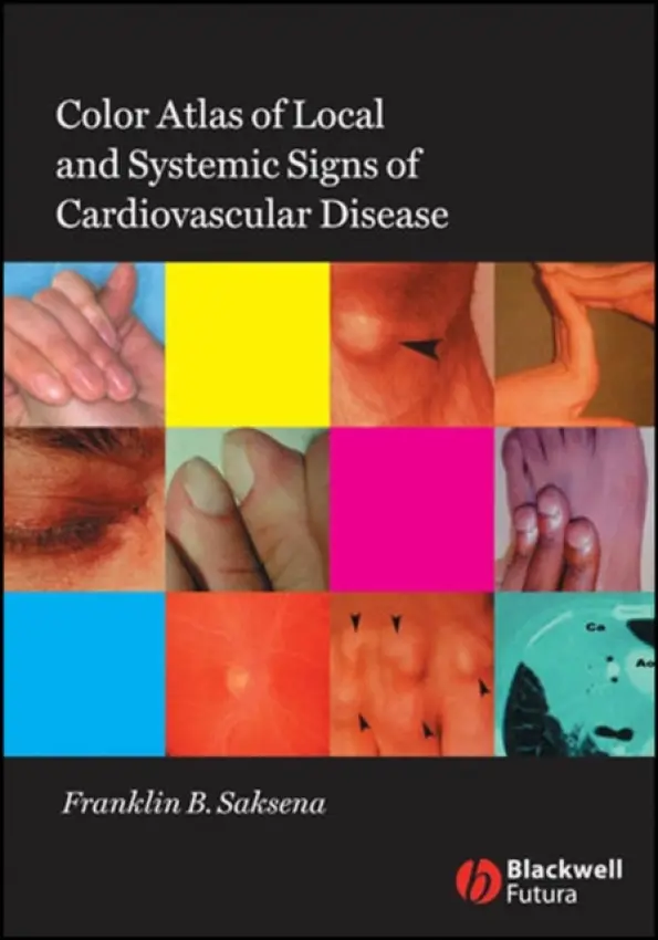 Color Atlas of Local and Systemic Manifestations of Cardiovascular Disease - Saksena, Franklin B.