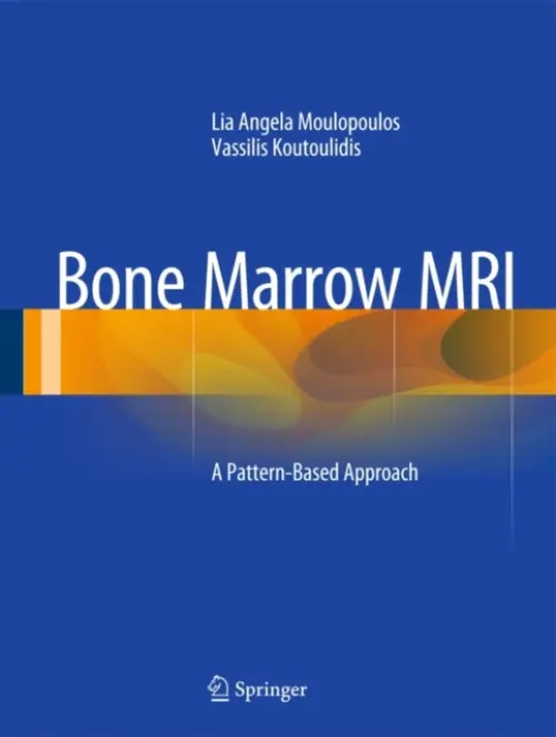 Bone Marrow MRI - Moulopoulos, Lia Angela a Koutoulidis, Vassilis