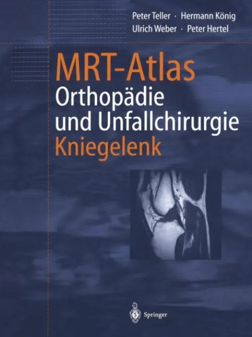 MRT-Atlas Orthopadie und Unfallchirurgie - Teller, Peter a Konig, Hermann a Weber, Ulrich a Hertel, Peter