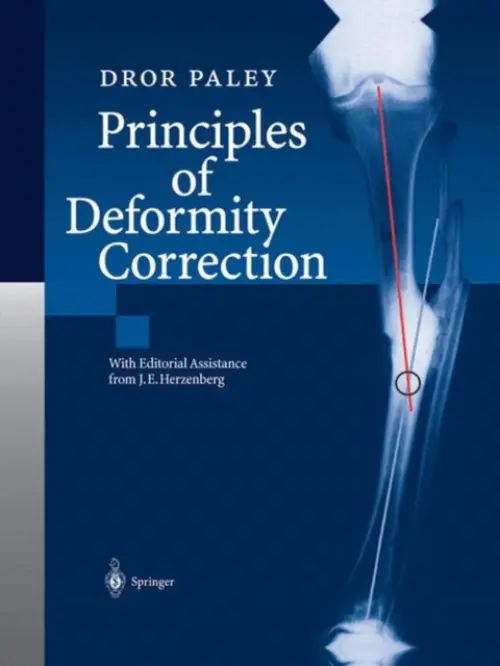 Principles of Deformity Correction - Paley, Dror