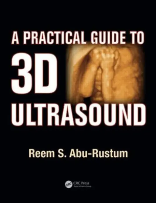 Practical Guide to 3D Ultrasound - Abu-Rustum, Reem S.