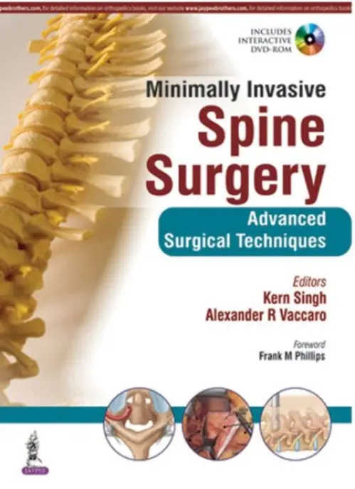 Minimally Invasive Spine Surgery - Singh, Kern a Vaccaro, Alexander