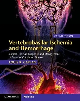 Vertebrobasilar Ischemia and Hemorrhage - Caplan, Louis R.