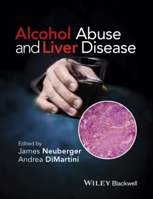 Alcohol Abuse and Liver Disease - DiMartini, Andrea (University of Pittsburgh, USA)