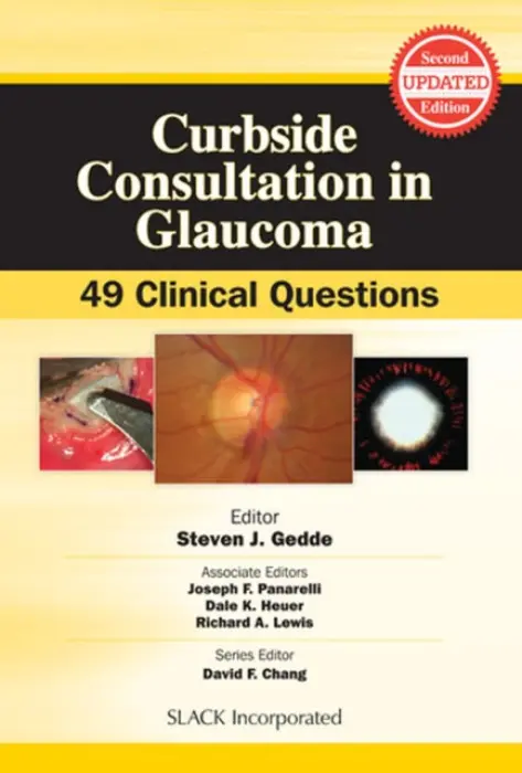 Curbside Consultation in Glaucoma - Gedde, Steven