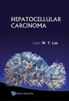 Hepatocellular Carcinoma - Lau, Joseph W Y (Chinese Univ Of Hong Kong, Hong Kong)