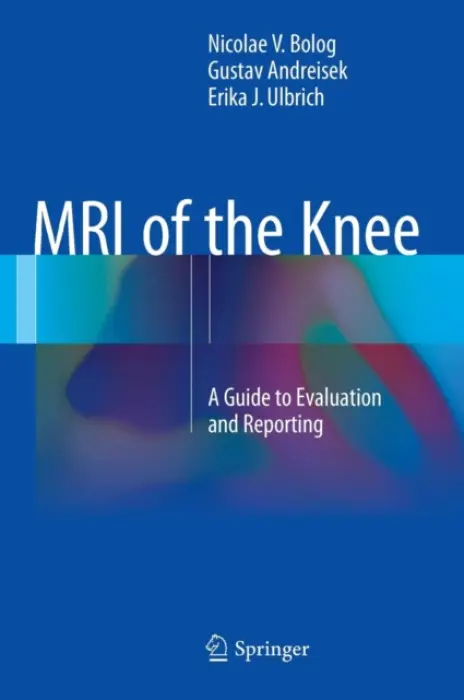 MRI of the Knee - Bolog, Nicolae V. a Andreisek, Gustav a Ulbrich, Erika J.
