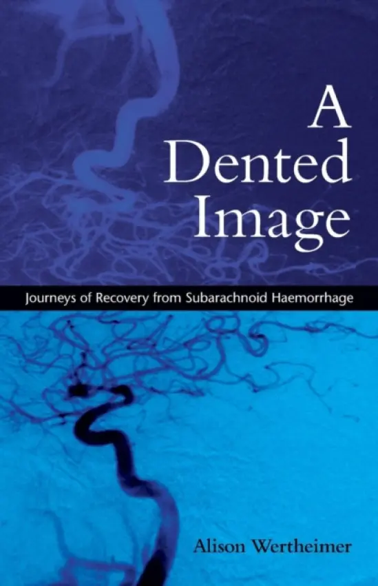 Dented Image - Wertheimer, Alison