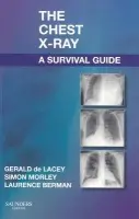 Chest X-Ray: A Survival Guide - de Lacey, Gerald, MA, FRCR (Consultant Radiologist to www.radiology-courses.com and formerly Consultant Radiologist at Northwick Park Hospital, London, UK) a Morley, Simon (Consultant Radiologist, University College Hospitals, London, UK) a Berman, Laurence (