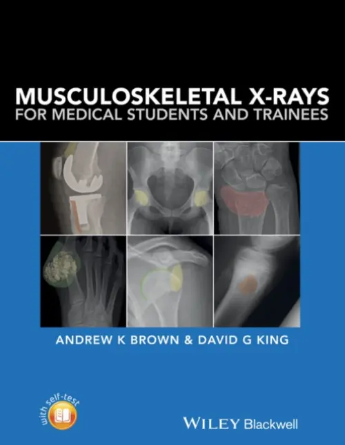 Musculoskeletal X-Rays for Medical Students and Trainees - Brown, Andrew K. (Consultant Rheumatologist and Senior Lecturer in Medical Education, Hull York Medical School) a King, David G. (Consultant Musculoskeletal Radiologist, The York Teaching Hospital)
