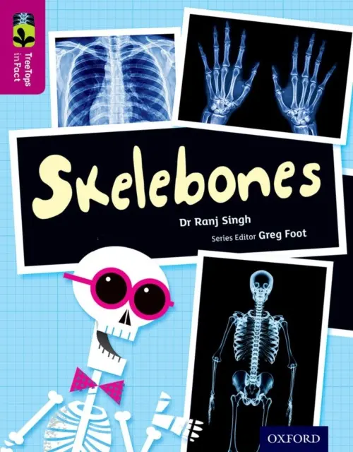 Oxford Reading Tree TreeTops inFact: Level 10: Skelebones - Singh, Ranj