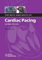 Nuts and Bolts of Cardiac Pacing - Kenny, Tom (St. Jude Medical, Austin, Texas)