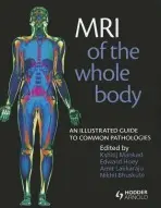 MRI of the Whole Body - Bhuskute, Nikhil a Hoey, Edward a Lakkaraju, Amit a Mankad, Kshitij