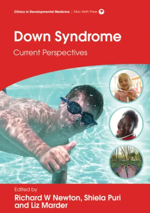 Down Syndrome - Newton, Richard W. a Marder, Liz a Puri, Shiela C.