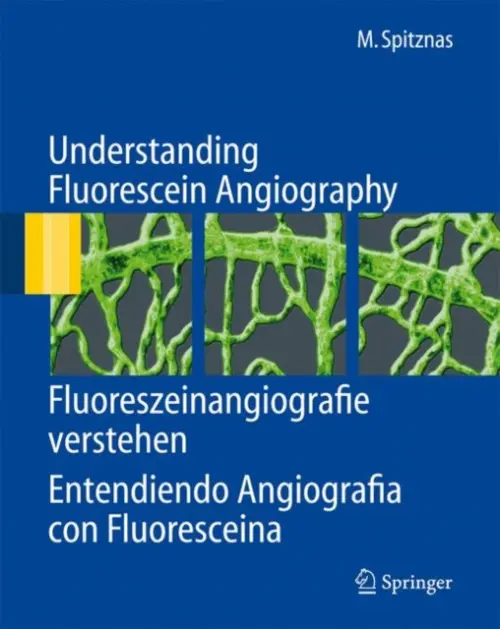 Understanding Fluorescein Angiography, Fluoreszeinangiografie verstehen, Entendiendo Angiografia con Fluoresceina - Spitznas, Manfred
