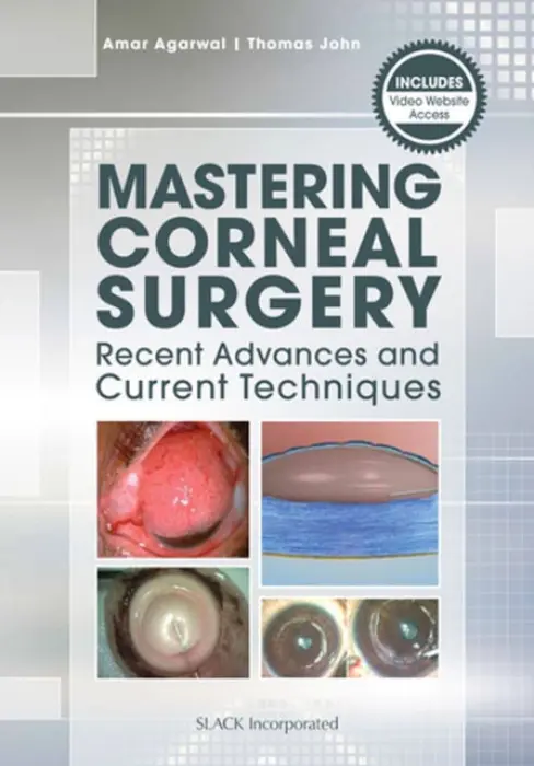 Mastering Corneal Surgery - Agarwal, Amar a John, Thomas