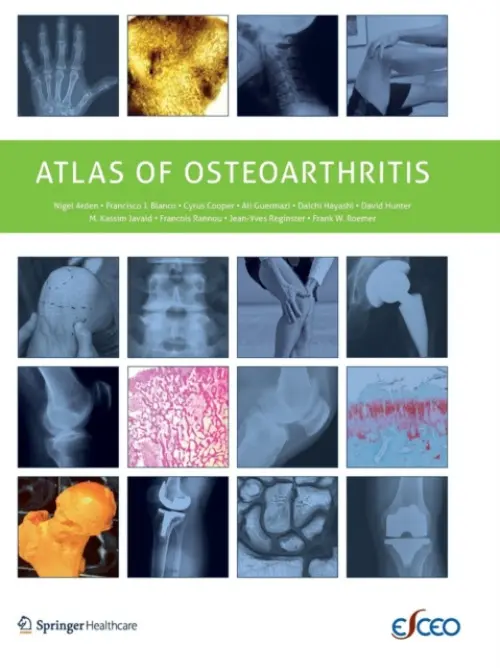 Atlas of Osteoarthritis - Arden, Nigel a Blanco, Francisco a Cooper, C. a Guermazi, Ali a Hayashi, Daichi a Hunter, David a Javaid, M. Kassim a Rannou, Francois a Roemer, Frank a Reginster, Jean-Yves