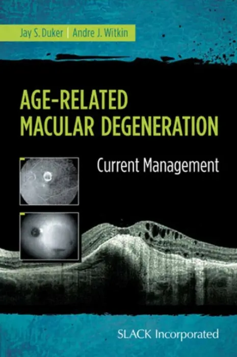 Age-Related Macular Degeneration - Duker, Jay a Witkin, Andre