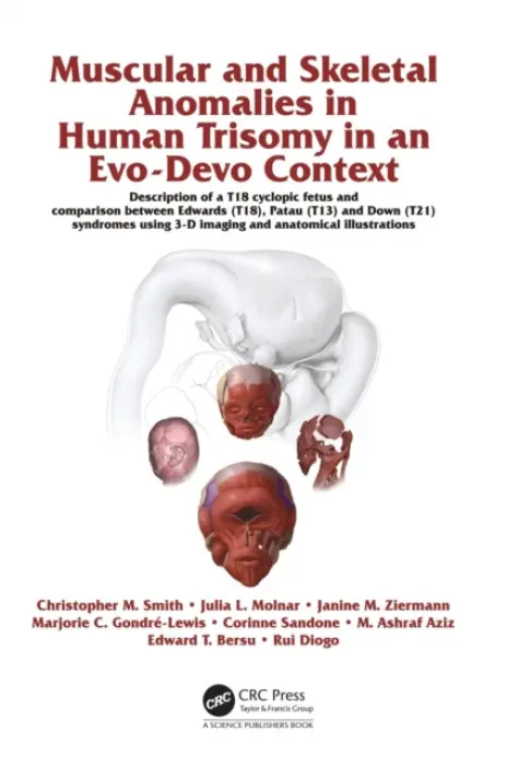 Muscular and Skeletal Anomalies in Human Trisomy in an Evo-Devo Context - Diogo, Rui a Smith, Christopher M. a Ziermann, Janine M. a Molnar, Julia a Gondre-Lewis, Marjorie C. a Sandone, Corinne a Bersu, Edward T. a Aziz, Mohammed Ashraf