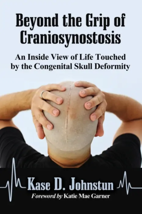 Beyond the Grip of Craniosynostosis - Johnstun, Kase D.