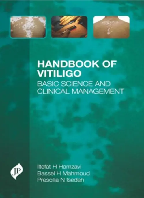 Handbook of Vitiligo - Hamzavi, Iltefat a Mahmoud, Bassel H. a Isedeh, Prescilia N.