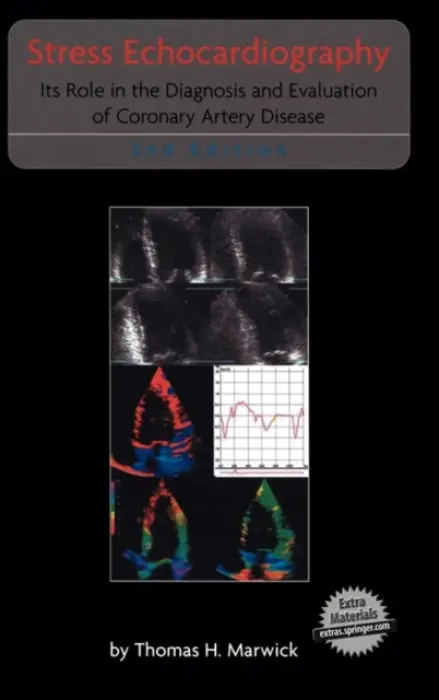 Stress Echocardiography - Marwick, Thomas H.