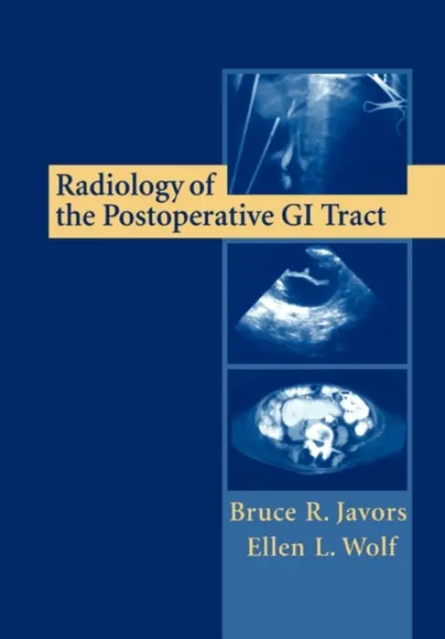 Radiology of the Postoperative GI Tract - Javors, Bruce R. a Wolf, Ellen L.