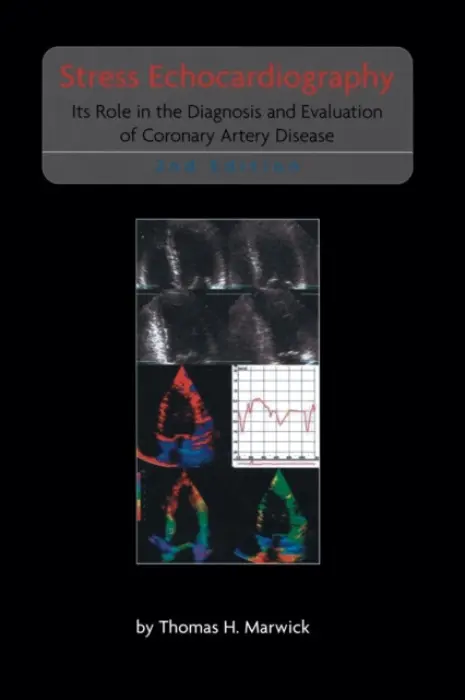 Stress Echocardiography - Marwick, Thomas H.