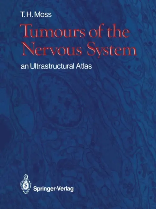 Tumours of the Nervous System - Moss, Timothy H.