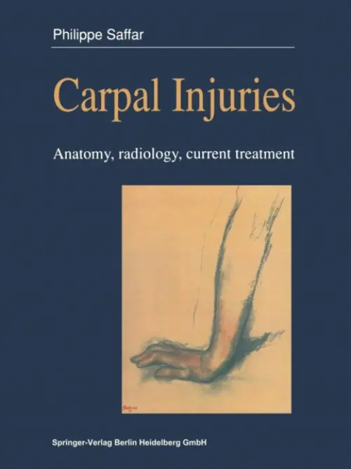 Carpal injuries - Saffar, Philippe