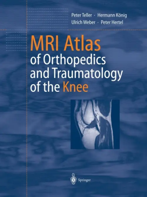 MRI Atlas of Orthopedics and Traumatology of the Knee - Teller, Peter a Konig, Hermann a Weber, Ulrich a Hertel, Peter