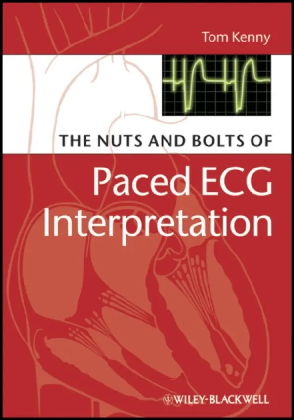 Nuts and bolts of Paced ECG Interpretation - Kenny, Tom (St. Jude Medical, Austin, Texas)