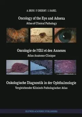 Oncology of the Eye and Adnexa / Oncologie de l'il et des Annexes / Onkologische Diagnostik in der Ophthalmologie - Brini, A. a Dhermy, A. a Sahel, J.