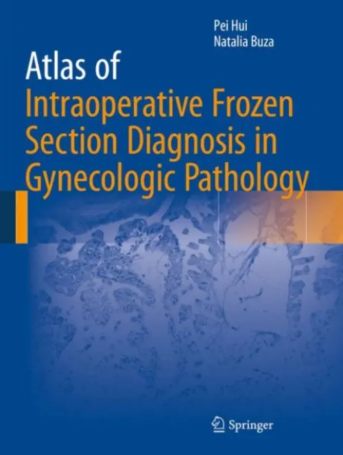 Atlas of Intraoperative Frozen Section Diagnosis in Gynecologic Pathology - Hui, Pei a Buza, Natalia