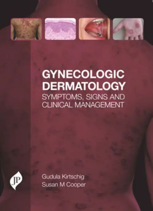 Gynecologic Dermatology - Kirtschig, Gudula a Cooper, Susan