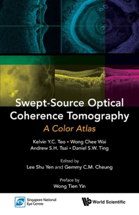 Swept-source Optical Coherence Tomography: A Color Atlas - Teo, Kelvin Yi Chong (S'pore National Eye Centre, S'pore) a Wong, Chee Wai (S'pore National Eye Centre, S'pore) a Tsai, Andrew Shih Hsiang (S'pore National Eye Centre, S'pore) a Ting, Daniel Shu Wei (S'pore National Eye Centre, S'pore)
