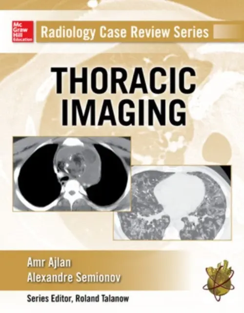 Radiology Case Review Series: Thoracic Imaging - Ajlan, Amr a Semionov, Alexander