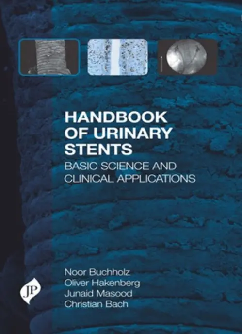 Handbook of Urinary Stents - Buchholz, Noor a Hakenberg, Oliver a Masood, Junaid a Bach, Christian