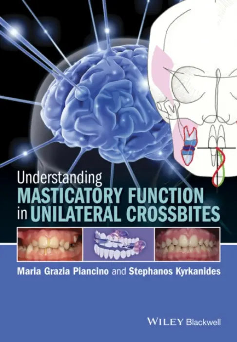 Understanding Masticatory Function in Unilateral Crossbites - Piancino, Maria Grazia (University of Turin, Turin, Italy) a Kyrkanides, Stephanos (Stony Brook University School of Dental Medicine, Stony Brook, New York)