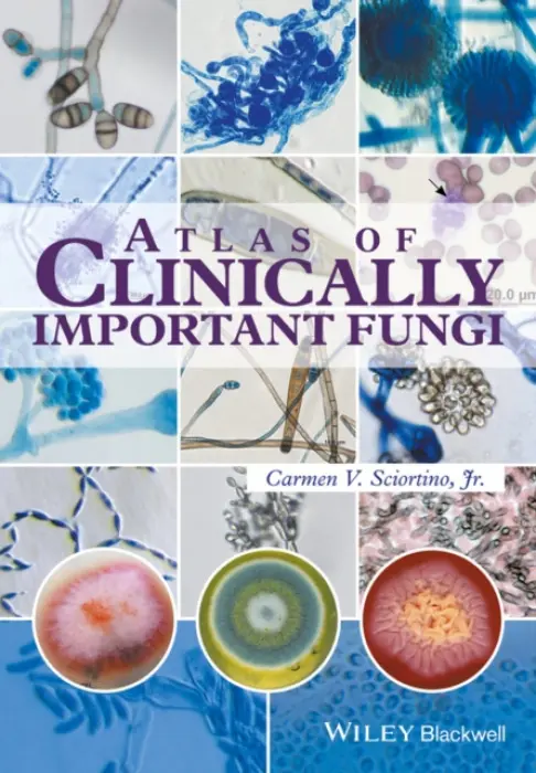 Atlas of Clinically Important Fungi - Sciortino, Carmen V., Jr.