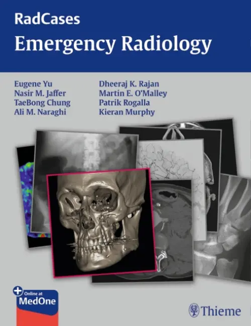 Radcases Emergency Radiology - Yu, Eugene a Jaffer, Nasir a Chung, TaeBong a Naraghi, Ali M. a Rajan, Dheeraj a O'Malley, Martin a Murphy, Kieran