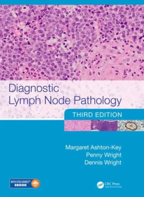 Diagnostic Lymph Node Pathology - Ashton-Key, Margaret (University of Southampton, Southhampton, UK) a Wright, Penny (Cambridge University Hospitals, Cambridge, UK) a Wright, Dennis (University of Southampton, Southampton, UK)