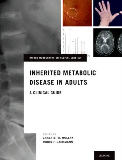 Inherited Metabolic Disease in Adults