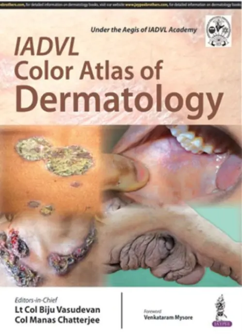 IADVL Color Atlas of Dermatology - Vasudevan, Biju a Chatterjee, Manas