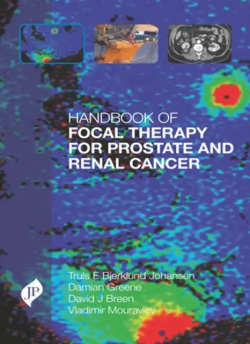 Handbook of Focal Therapy for Prostate and Renal Cancer - Johansen, Truls Bjerklund a Greene, Damian a Breen, David J a Mouraviev, Vladimir