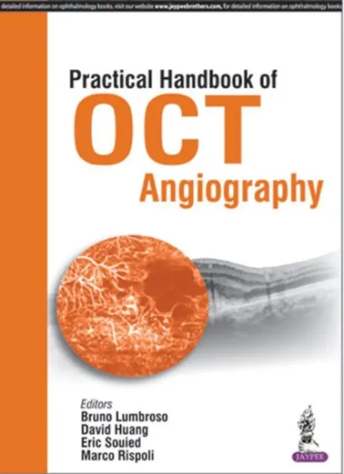 Practical Handbook of OCT Angiography - Lumbroso, Bruno a Huang, David a Souied, Eric a Rispoli, Marco