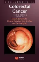 Challenges in Colorectal Cancer