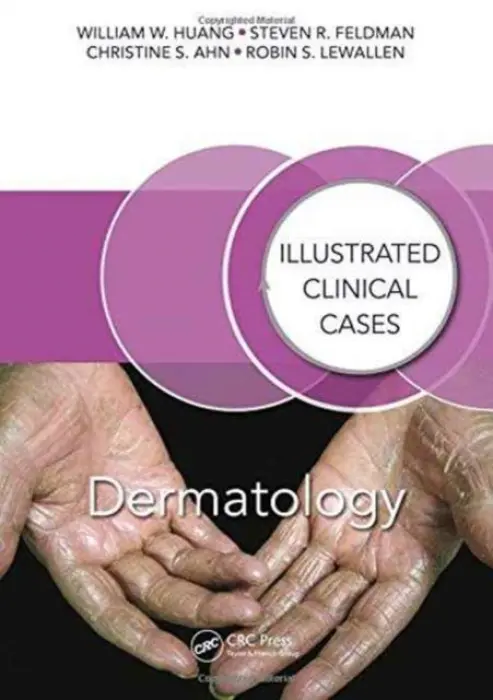 Dermatology - Huang, William W. (Wake Forest University, Winston-Salem, North Carolina, USA) a Feldman, Steven R. (Wake Forest Baptist Health, Winston Salem, North Carolina, USA) a Ahn, Christine S. (Wake Forest School of Medicine, Winston Salem, North Carolina, USA) a Lewal
