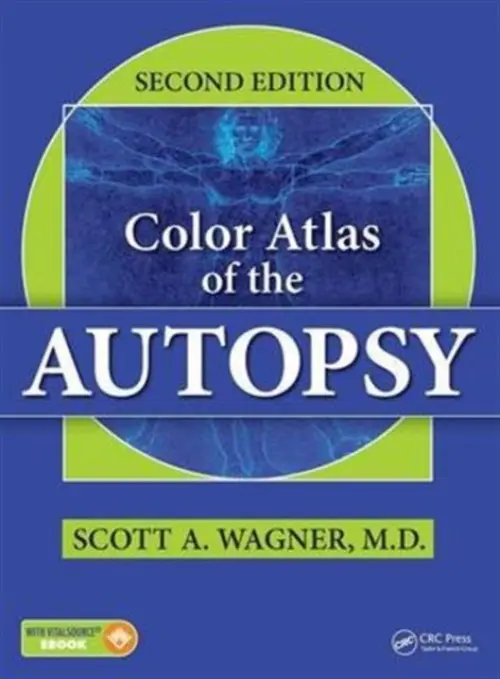 Color Atlas of the Autopsy - Wagner, Scott A. (Wagner Research, LLC, and Northeast Indiana Forensic Center, Fort Wayne, Indiana, USA)