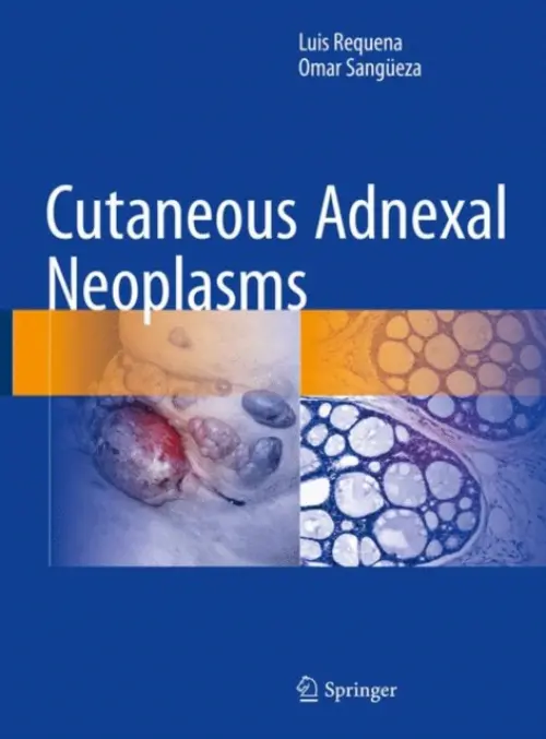 Cutaneous Adnexal Neoplasms - Requena, Luis a Sangueza, Omar